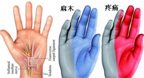 麻木.jpg